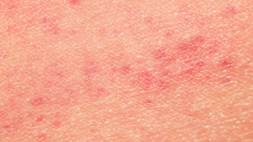 How to Improve Skin Texture