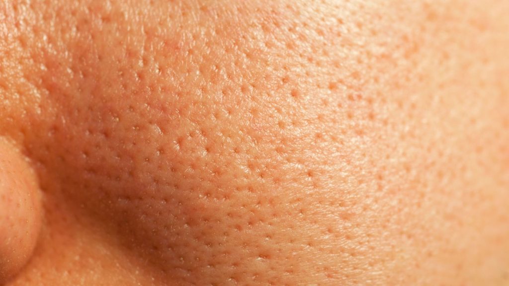 How to Improve Skin Texture